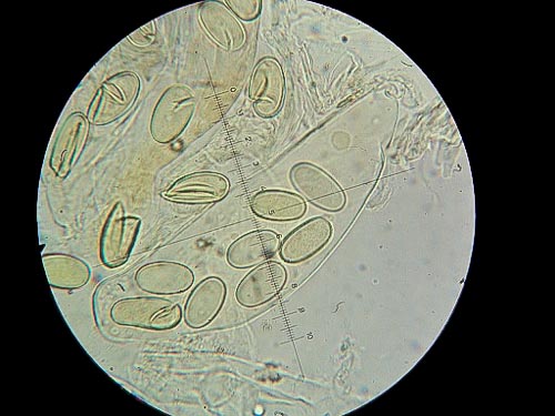 Lasiobolus cuniculi